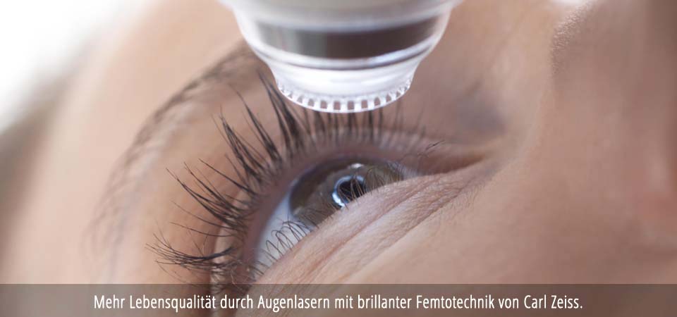 (c) Augenlasern-antalya.de